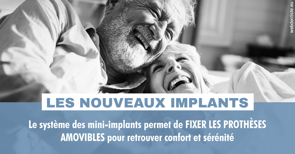https://selarl-klejman.chirurgiens-dentistes.fr/Les nouveaux implants 2