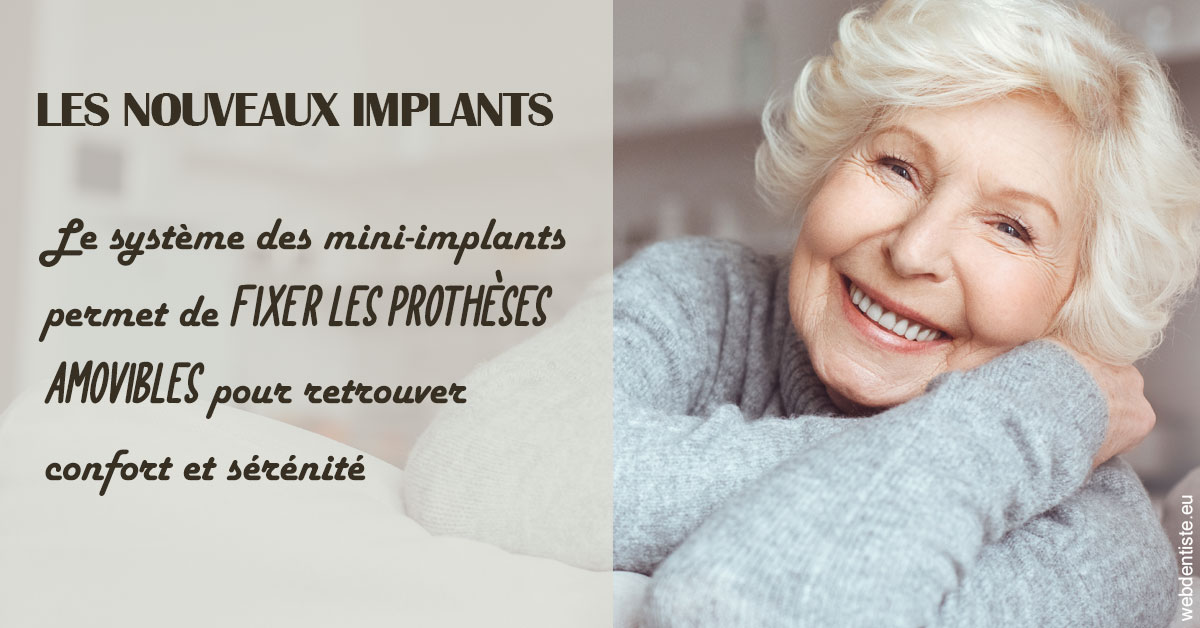 https://selarl-klejman.chirurgiens-dentistes.fr/Les nouveaux implants 1