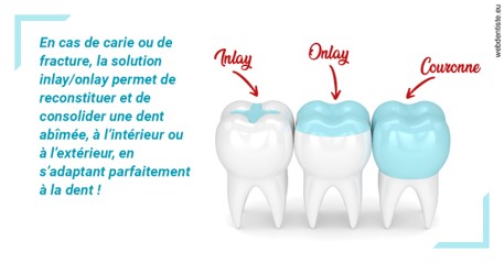 https://selarl-klejman.chirurgiens-dentistes.fr/L'INLAY ou l'ONLAY