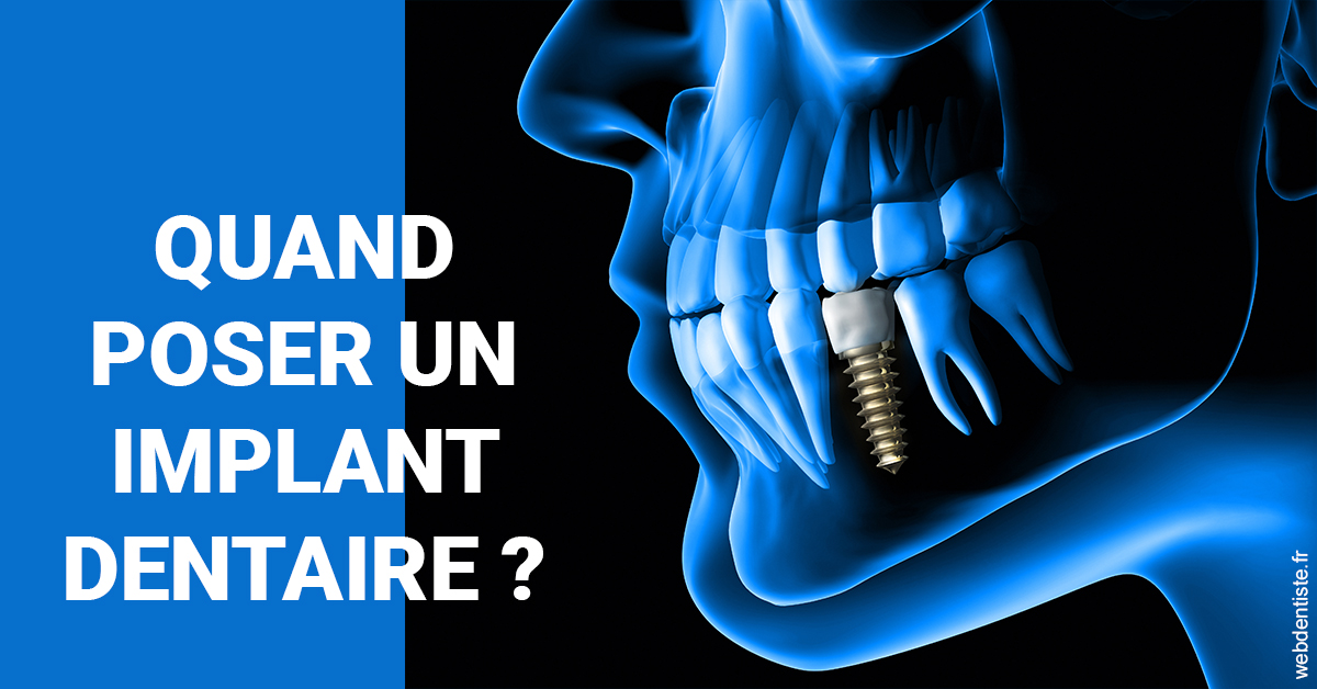 https://selarl-klejman.chirurgiens-dentistes.fr/Les implants 1