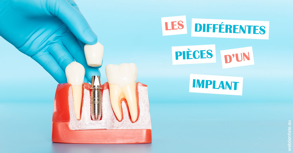 https://selarl-klejman.chirurgiens-dentistes.fr/Les différentes pièces d’un implant 2