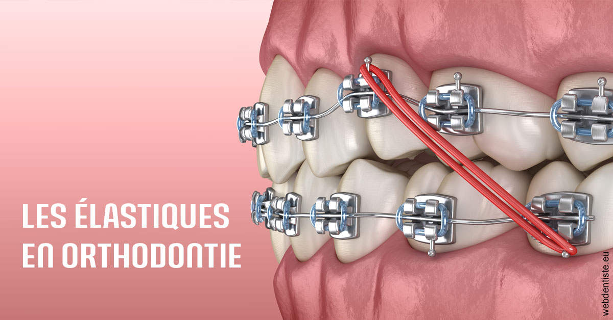 https://selarl-klejman.chirurgiens-dentistes.fr/Elastiques orthodontie 2