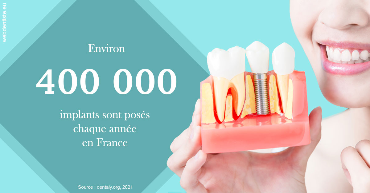 https://selarl-klejman.chirurgiens-dentistes.fr/Pose d'implants en France 2