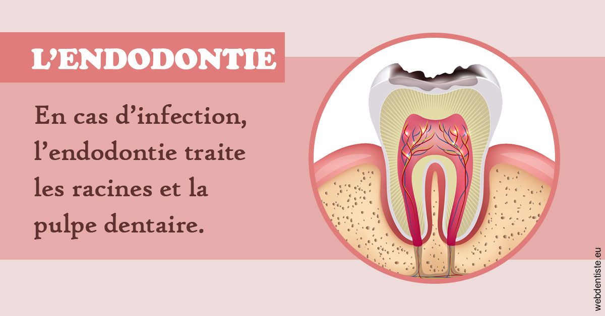 https://selarl-klejman.chirurgiens-dentistes.fr/L'endodontie 2