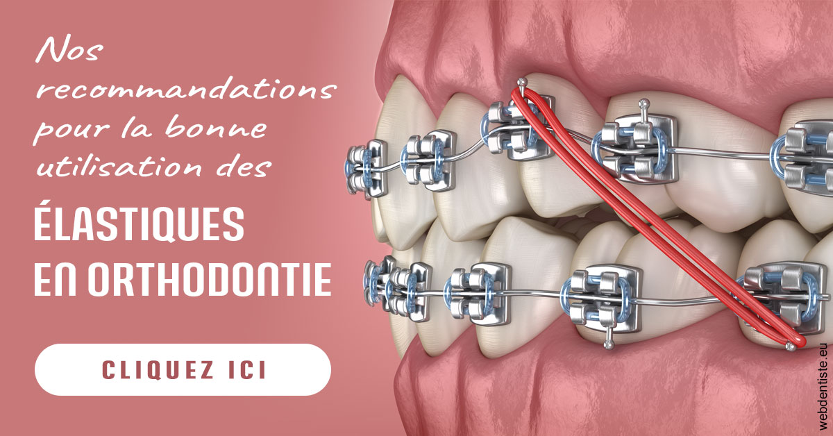 https://selarl-klejman.chirurgiens-dentistes.fr/Elastiques orthodontie 2